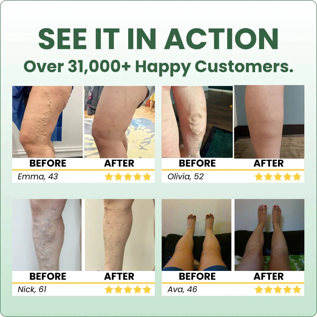 Sorviq™ Miracle Balm Spring