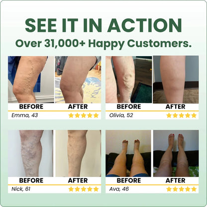 Sorviq™ Miracle Balm Spring